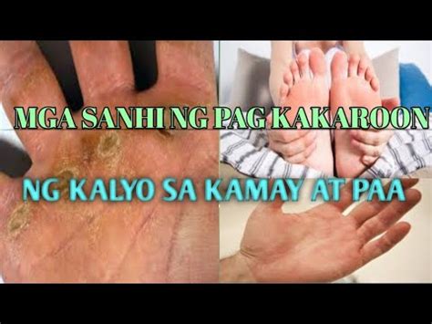 kalyo sa paa in english|Google Translate.